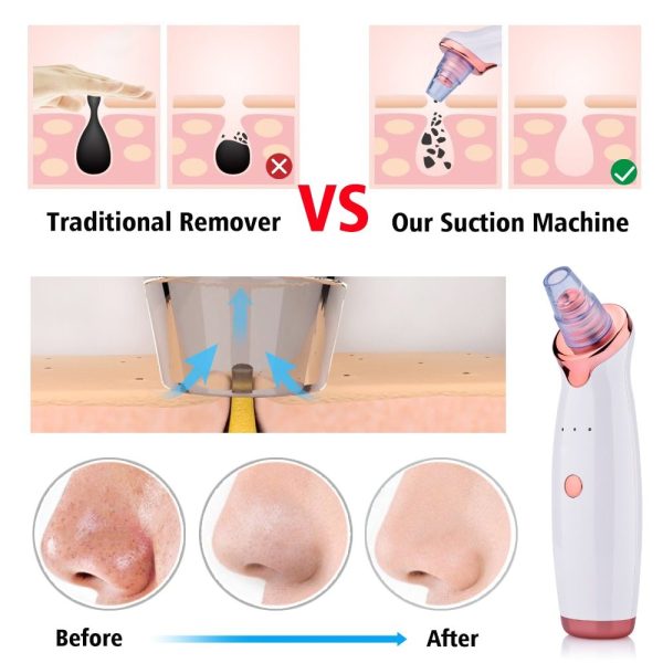 Blackhead Instrument Electric Suction Facial Washing Instrument Beauty Acne Cleaning Blackhead Suction Instrument - Image 9