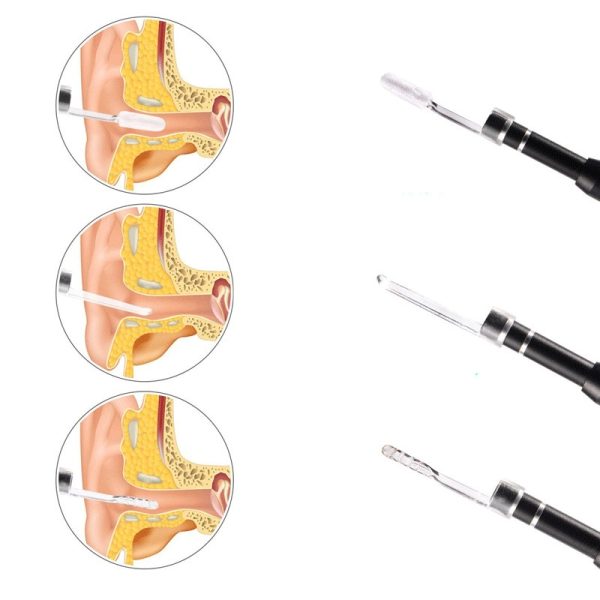 The New 5.5mm Three-in-one Ear Spoon Visual Ear Endoscope Ear Canal Endoscope 1m - Image 5