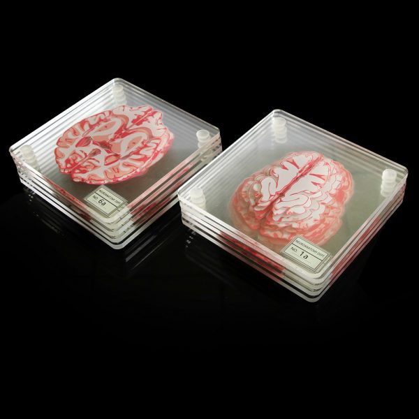 Creative Floral Brain Slices Acrylic Coasters Party Favors - Image 3