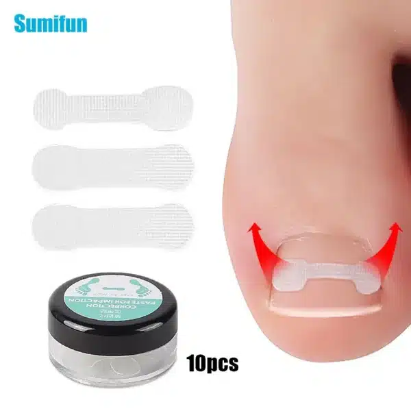 10pc/box Ingrown Toenail Correction Tool Straightening Clip Brace Ingrown Toe Nail Treatment Elastic Patch Sticker Pedicure Tool