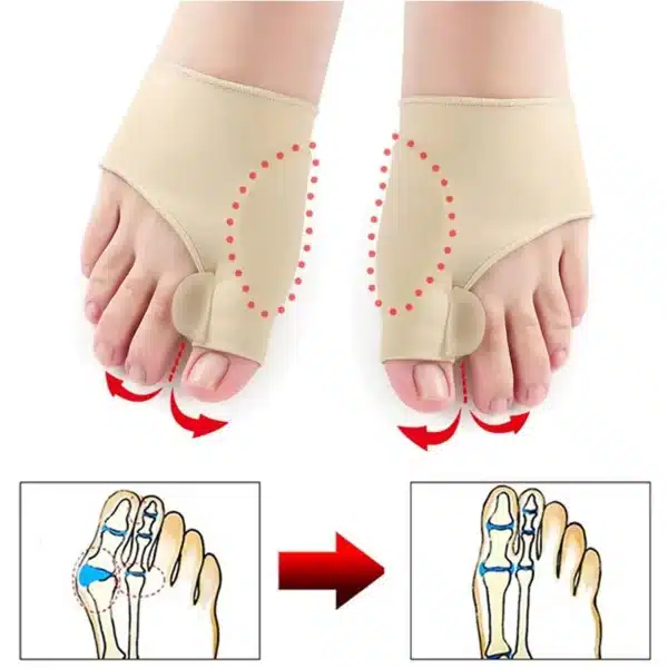 Toe Separator Hallux Valgus Bunion Corrector Orthotics Feet Bone Thumb Adjuster Correction Pedicure Sock Straightener Foot Care