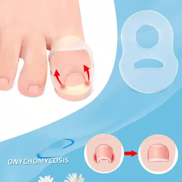 1/2pcs Silicone Ingrown Toenail Correction Tool Invisible Ingrown Toe Nail Straightening Protector Brace Pedicure Feet Care Tool