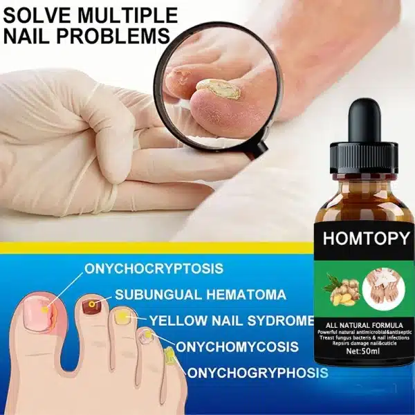 7 Days Nail Fungal Treatment Essence Oil Foot Toe Nail Fungus Removal Serum Repair Onychomycosi Anti Infection Gel Care Products