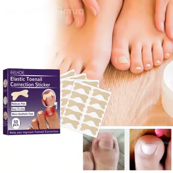 50pcs Nail Correction Stickers Ingrown Toenail Corrector Toe Nail Patches Paronychia Recover Repair Nails Foot Pedicure Tool