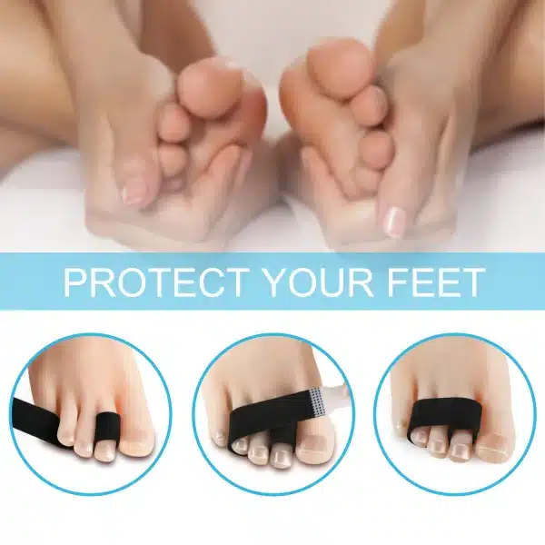 Black Toe Corrector Straightener Orthotics Wrap Cushioned Bandages Hammer Elastic Toe Separator Splints Tape Foot Care Tool - Image 2