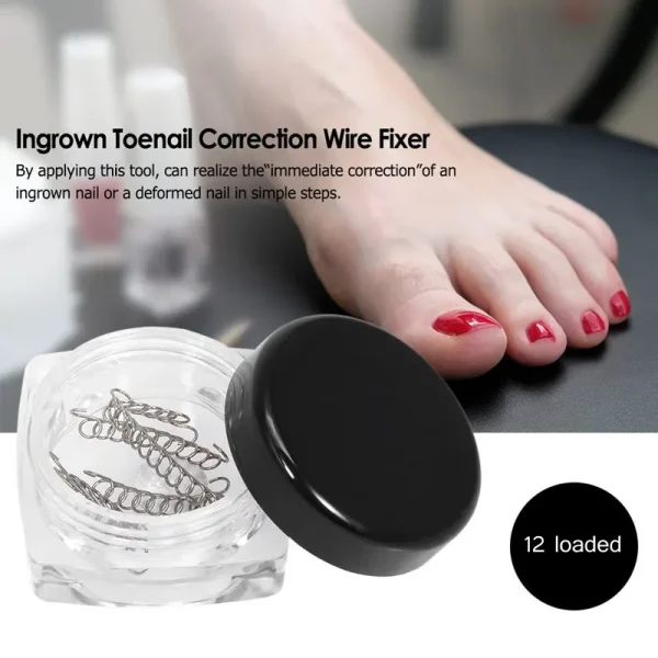 Tcare 1Set Fixer Pedicure Recover Ingrown Toenail Correction Wire Fixer Ingrown Toe Corrector Pedicure Treatment Foot Care Tool - Image 6