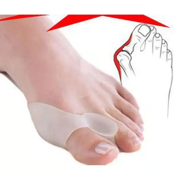 Silicone Gel Bunion Big Toe Separator Spreader Eases Foot Pain Foot Hallux Valgus Correction Guard Cushion Concealer Thumb 1Pair - Image 6