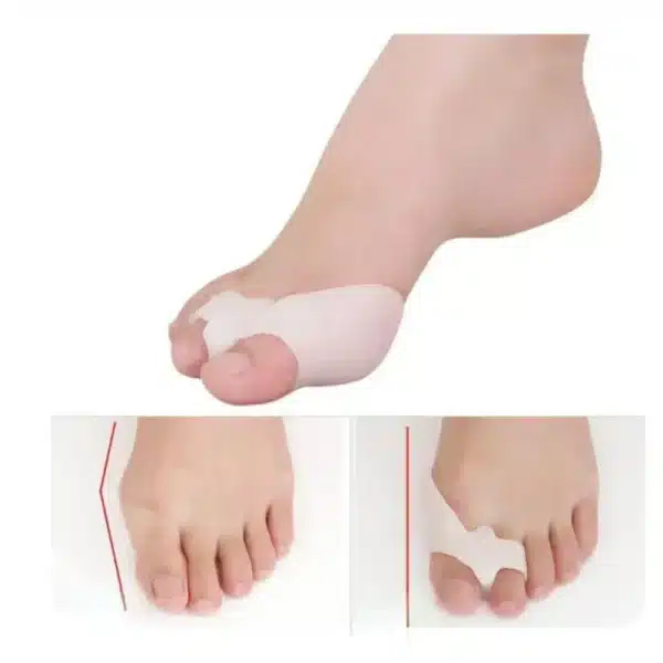 1Pair Silicone Gel Foot Fingers Two Hole Toe Separator Thumb Valgus Protector Bunion Adjuster Hallux Valgus Guard Feet Care - Image 2