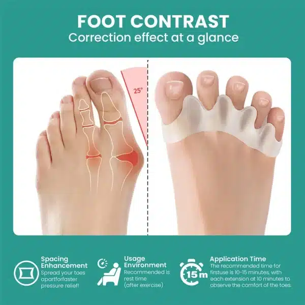 1 Pair Silicone Toe Separator, Bunion Corrector,Hammer Toe Corrector, Soft Silicone Material for Toe Separation Foot Care Tool - Image 3