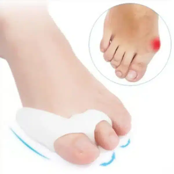 Hallux Valgus Corrector Orthopedic Big Toe Bone Thumb Bunion Corrector Silicone Socks for Legs Foot Care Tools Belleza Y Salud - Image 5