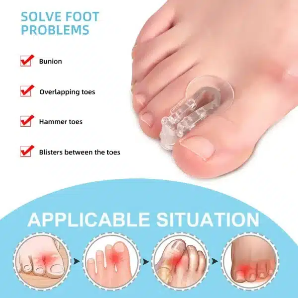 Foot Care Tools Toe Orthosis Clip Pads Big Foot Bone Care Tools Splitter Thumb Hallux Valgus Bunion Corrector Overlap Separators - Image 3