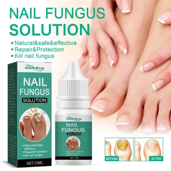 Extra Strong Nail Fungus Treatment Serum Essence oil Feet Nails Repair Care Essence Cream Anti Infection Toe Fungal Removal - Image 2