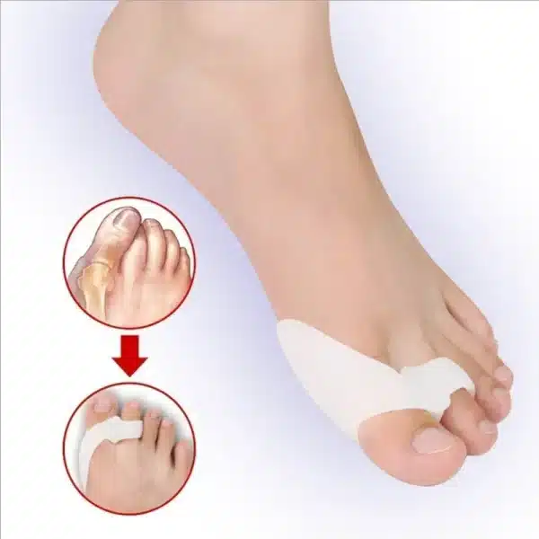 1Pair Silicone Gel Foot Fingers Two Hole Toe Separator Thumb Valgus Protector Bunion Adjuster Hallux Valgus Guard Feet Care - Image 5