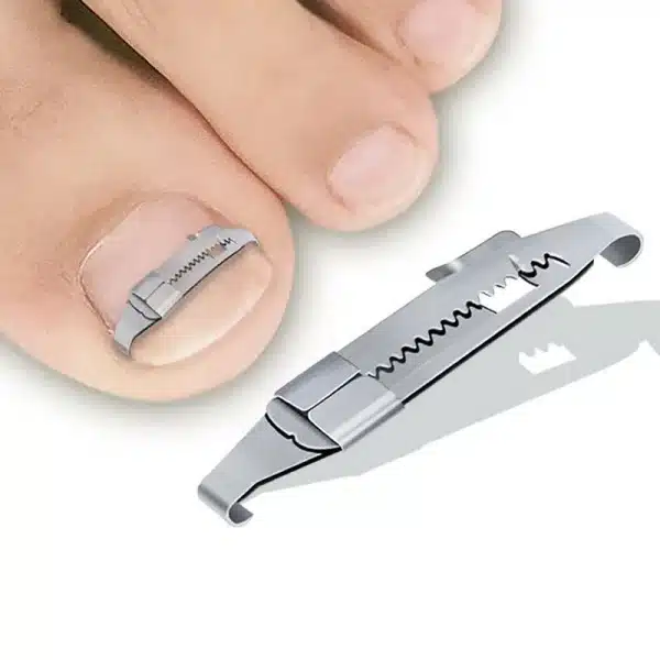 Toe Ingrown Pedicure Nail Buckle Toenails Corrector Foot Nail Correction Tool Straightening Clip Curved Brace Corrector - Image 2