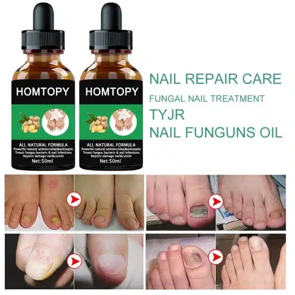 7 Days Nail Fungal Treatment Essence Oil Foot Toe Nail Fungus Removal Serum Repair Onychomycosi Anti Infection Gel Care Products - Image 3