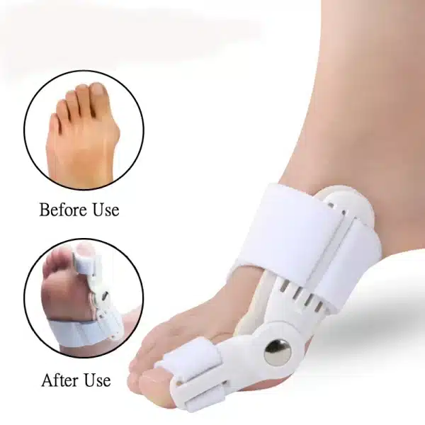 Big Toe Straightener Corrector Splint Foot Pain Relief Hallux Valgus Correction Orthopedic Supplies Pedicure Foot Care - Image 6