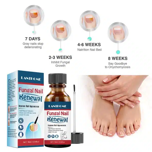 1-10pcs Repair Nail Fungal Treatmen Essence oil Anti Infection Onychomycosis Removal Toe Nail Foot Fungus Paronychia Nail Fungu - Image 5