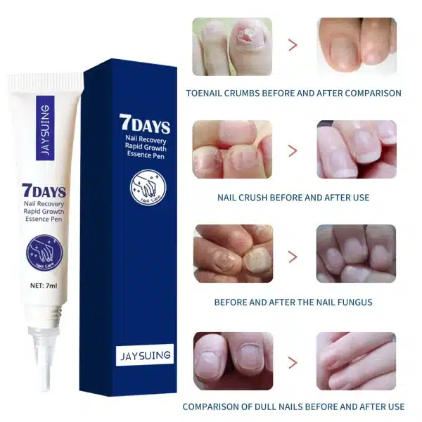 7ml Nail Recovery Rapid Growth Essence Pen Nail Foot Toe Care and Nourishment 98% of Customers Repurchase and Get Perfect - Image 2