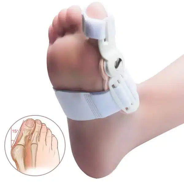 1Pair Bunion Separator Corrector Hallux Valgus Orthopedic Braces Toe Bone Thumb Orthotics Tool Foot Care Toe Splint Straightener - Image 3