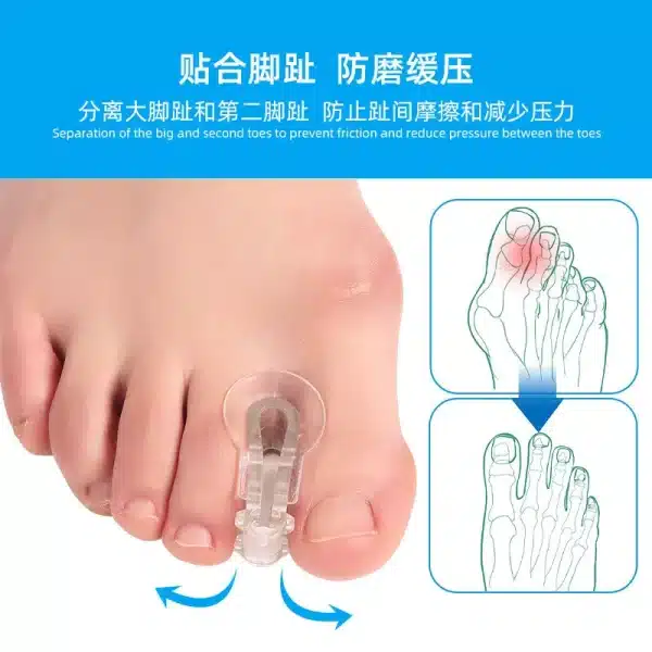 족저근막염 2Pcs Big Foot Bone Splitter Toe Orthosis Clip Pad Thumb Hallux Valgus Overlapping Silicone Separator Bunion Corrector 발톱무좀 - Image 3