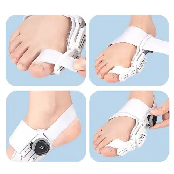 Bunion Corrector Unisex Foot Hallux Valgus Braces Rotatable Toe Separator Straightener Adjustable Pedicure Finger Toe Corrector - Image 6