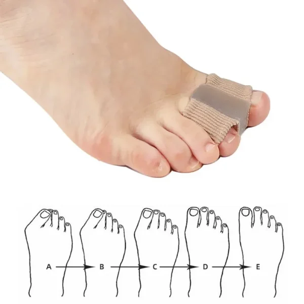 Toe Separator Gel Bunion Corrector Silicone Gel Thumb Corrector Foot Toe Hallux Valgus Protector Finger Straightener Sleeve Tube - Image 5