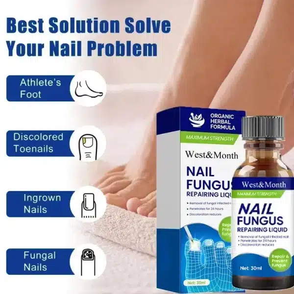 Fungal Nail Treatment Removal Oil Foot Fungus Repair Essence Toe Fungus Removal Gel Anti Infection Onychomycosis Essenice - Image 3