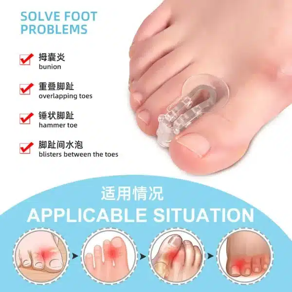 족저근막염 2Pcs Big Foot Bone Splitter Toe Orthosis Clip Pad Thumb Hallux Valgus Overlapping Silicone Separator Bunion Corrector 발톱무좀 - Image 2