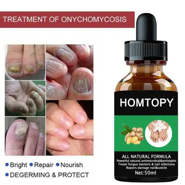 7 Days Nail Fungal Treatment Essence Oil Foot Toe Nail Fungus Removal Serum Repair Onychomycosi Anti Infection Gel Care Products - Image 2