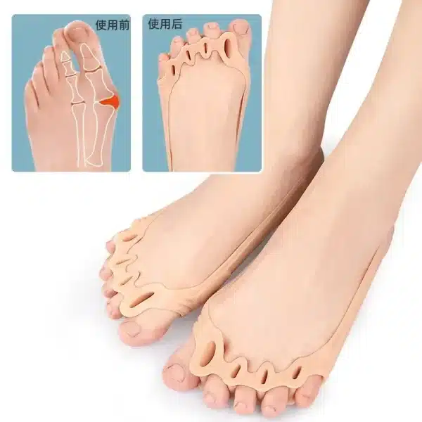 5 Holes Silicone Toe Separator Metatarsal Pad Pain Relief Forefoot Socks Insole Bunion Orthotics Hallux Valgus Corrector 발가락교정기 - Image 3