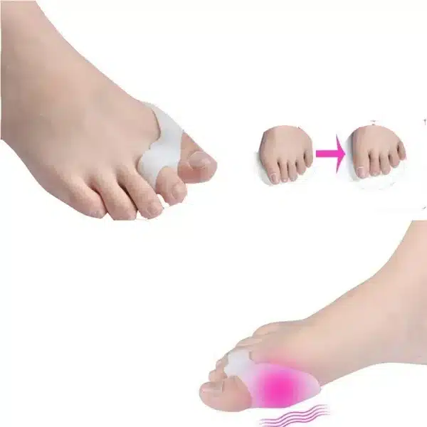 1Pair Silicone Gel Foot Fingers Two Hole Toe Separator Thumb Valgus Protector Bunion Adjuster Hallux Valgus Guard Feet Care - Image 4