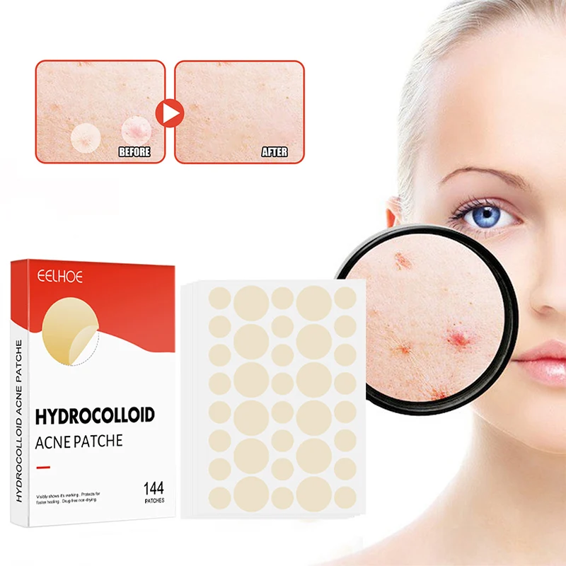 144pcs/set Face Skin Care Acne Pimple Patch 2 Sizes Invisible Professional Healing Absorbing Spot Sticker Covering for Men Women 1