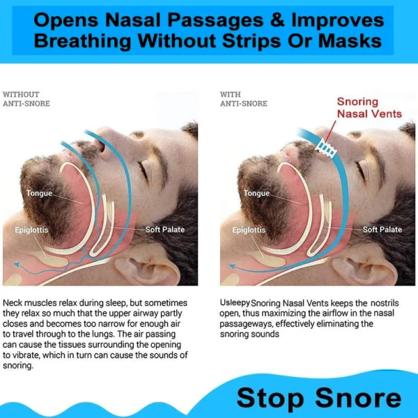 8PCS Anti Snoring Nasal Dilator Nose Clip Anti Snore Stopping Snoring Silent Sleep Aid Device for Men Antisnoring Anti Ronco 3