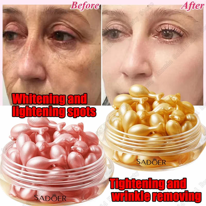 Freckle Whitening Serum Black Dots Melasma Remover Anti Brown Stain Lighten Pigmentation Moisturizing Skin Care Korean Products