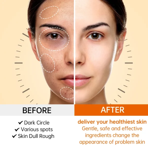 JoyPretty Vitamin C Skin Care Set Face Whitening Dark Spots Cream Serum Gentle Cleaning Deep Moisturizing Pore Shrinkle Skincare - Image 5