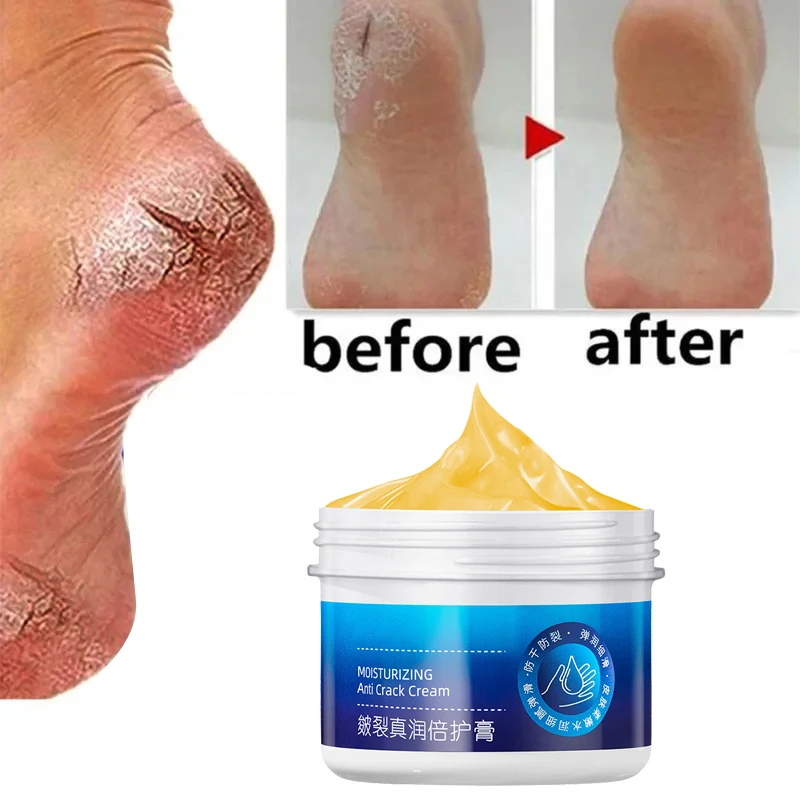 Anti-Drying Crack Foot Hand Cream Heel Cracked Repair Hand Feet Mask Moisturizing Whitening Dead Skin Removal Skin Care